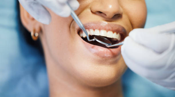 Best Emergency Wisdom Teeth Removal in Lake Wilderness, VA